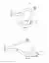 Fig. 03 - Range of motion exercise therapy band