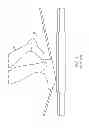 Fig. 02 - BALANCE TRAINING AID
