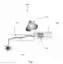 Fig. 02 - ELECTRONIC-BASED BIOSENSOR