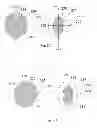 Fig. 09 - Lysine delivery systems for blood coagulation