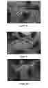 Fig. 12 - Small molecule xanthine oxidase inhibitors and methods of use