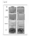 Fig. 05 - Predictive marker of DNMT1 inhibitor therapeutic efficacy and methods of using the marker