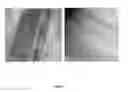 Fig. 09 - Substrate-independent layer-by-layer assembly using catechol-functionalized polymers