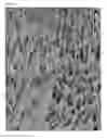 Fig. 13 - Porous tissue scaffolds