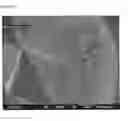 Fig. 17 - Porous tissue scaffolds