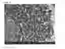Fig. 24 - Porous tissue scaffolds