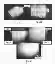 Fig. 31 - Foam-formed collagen strand