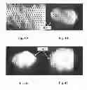 Fig. 32 - Foam-formed collagen strand