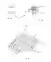 Fig. 33 - Foam-formed collagen strand