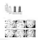 Fig. 02 - COLLATERAL BLOOD CIRCULATION DEVELOPMENT PROMOTER