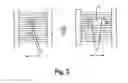 Fig. 04 - Method and device for radiation therapy treatment of multiple targets