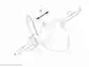 Fig. 01 - SYSTEMS AND METHODS FOR MAKING AND USING PERCUTANEOUSLY- DELIVERED PUMPING SYSTEMS FOR PROVIDING HEMODYNAMIC SUPPORT