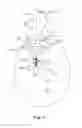 Fig. 08 - SYSTEMS AND METHODS FOR MAKING AND USING PERCUTANEOUSLY- DELIVERED PUMPING SYSTEMS FOR PROVIDING HEMODYNAMIC SUPPORT