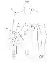 Fig. 09 - Methods and instruments for treating GERD and haital hernia