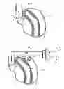 Fig. 32 - Methods and instruments for treating GERD and haital hernia