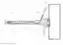 Fig. 01 - Postpyloric feeding device and methods for using thereof