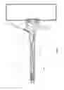 Fig. 02 - Postpyloric feeding device and methods for using thereof