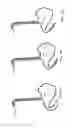 Fig. 21 - Postpyloric feeding device and methods for using thereof