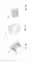 Fig. 25 - Postpyloric feeding device and methods for using thereof