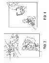 Fig. 04 - DEVICES AND METHODS FOR OBTAINING PHYSIOLOGICAL DATA