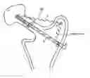 Fig. 01 - Method for detecting body parameters