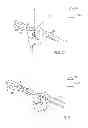 Fig. 04 - Use of micro- and miniature position sensing devices for use in TKA and THA