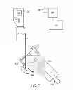 Fig. 07 - Use of micro- and miniature position sensing devices for use in TKA and THA
