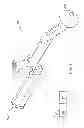 Fig. 08 - Use of micro- and miniature position sensing devices for use in TKA and THA
