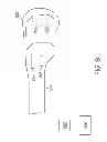 Fig. 09 - Use of micro- and miniature position sensing devices for use in TKA and THA