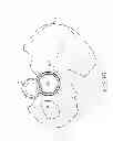 Fig. 15 - Use of micro- and miniature position sensing devices for use in TKA and THA