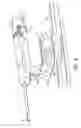 Fig. 09 - GRAPHICAL USER INTERFACE FOR TISSUE BIOPSY SYSTEM