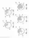 Fig. 15 - GRAPHICAL USER INTERFACE FOR TISSUE BIOPSY SYSTEM