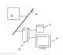 Fig. 01 - System for paranasal sinus and nasal cavity analysis