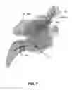 Fig. 08 - System for paranasal sinus and nasal cavity analysis