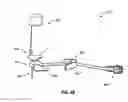 Fig. 24 - Assemblies for identifying a power injectable access port