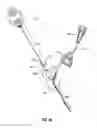 Fig. 28 - Assemblies for identifying a power injectable access port