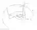 Fig. 01 - Implantable sonic windows
