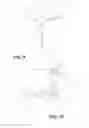 Fig. 10 - Implantable sonic windows