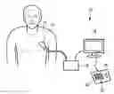 Fig. 01 - LARGE VOLUME THREE-DIMENSIONAL ULTRSAOUND IMAGING