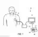 Fig. 02 - LARGE VOLUME THREE-DIMENSIONAL ULTRSAOUND IMAGING