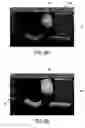 Fig. 07 - LARGE VOLUME THREE-DIMENSIONAL ULTRSAOUND IMAGING