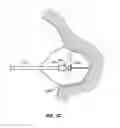 Fig. 03 - Systems and methods for measuring and characterizing interior surfaces of luminal structures