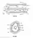 Fig. 10 - Systems and methods for measuring and characterizing interior surfaces of luminal structures
