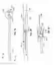 Fig. 11 - Systems and methods for measuring and characterizing interior surfaces of luminal structures