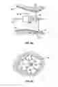 Fig. 13 - Systems and methods for measuring and characterizing interior surfaces of luminal structures