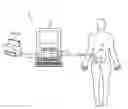 Fig. 01 - METHOD AND SYSTEM FOR TREATING CARDIOVASCULAR DISEASE