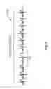 Fig. 05 - Systems and methods for processing and displaying patient electrocardiograph data