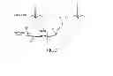 Fig. 06 - Methods, systems and devices for detecting atrial fibrillation