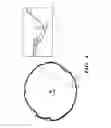 Fig. 04 - QUANTITATIVE METHODS AND SYSTEMS FOR NEUROLOGICAL ASSESSMENT