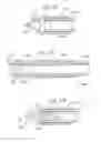 Fig. 11 - METHODS AND DEVICES FOR BIOPSY AND COLLECTION OF SOFT TISSUE